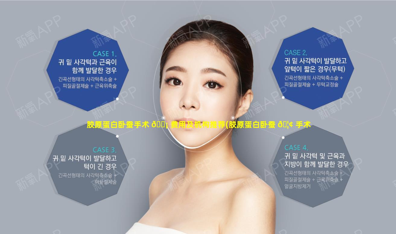 胶原蛋白卧蚕手术 🐡 费用及机构推荐(胶原蛋白卧蚕 🦢 手术费用及机构推荐图片)